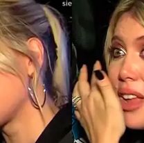 Las impactantes fotos del tratamiento de Wanda Nara: "A veces estoy así"