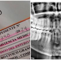 Lo asaltaron y le reventaron la mandíbula: necesitan dos millones para operarlo