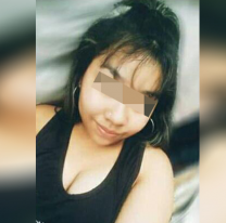 Entre dos, rociaron con alcohol a una joven jujeña. Está grave, tiene el 70% del cuerpo quemado