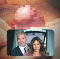 ¿Es un tumor? Barby Franco mostró lo que le sacaron en el parto de su hijo