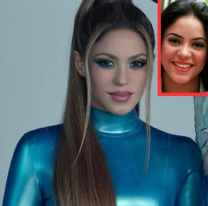 ¡Era directamente otra persona! Una a una las cirugías que se hizo Shakira